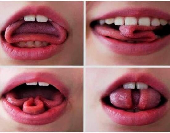 trixie tongue tricks